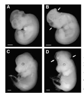 Neural tube defects in Shmt1-deficient embryos. A, B: At gestational day 11.5 (E11.5),Shmt1 +/-embryos from dams fed diets lacking folate exhibited failure of rostral neural tube closure at the midbrain/hindbrain boundary (B). All wild-type littermates (A) were unaffected. Arrows indicate extent of lesions. C, D: At E14.5, affected Shmt1+/- embryos (D) exhibited prominent exencephaly. Wild-type littermates (C) were unaffected.