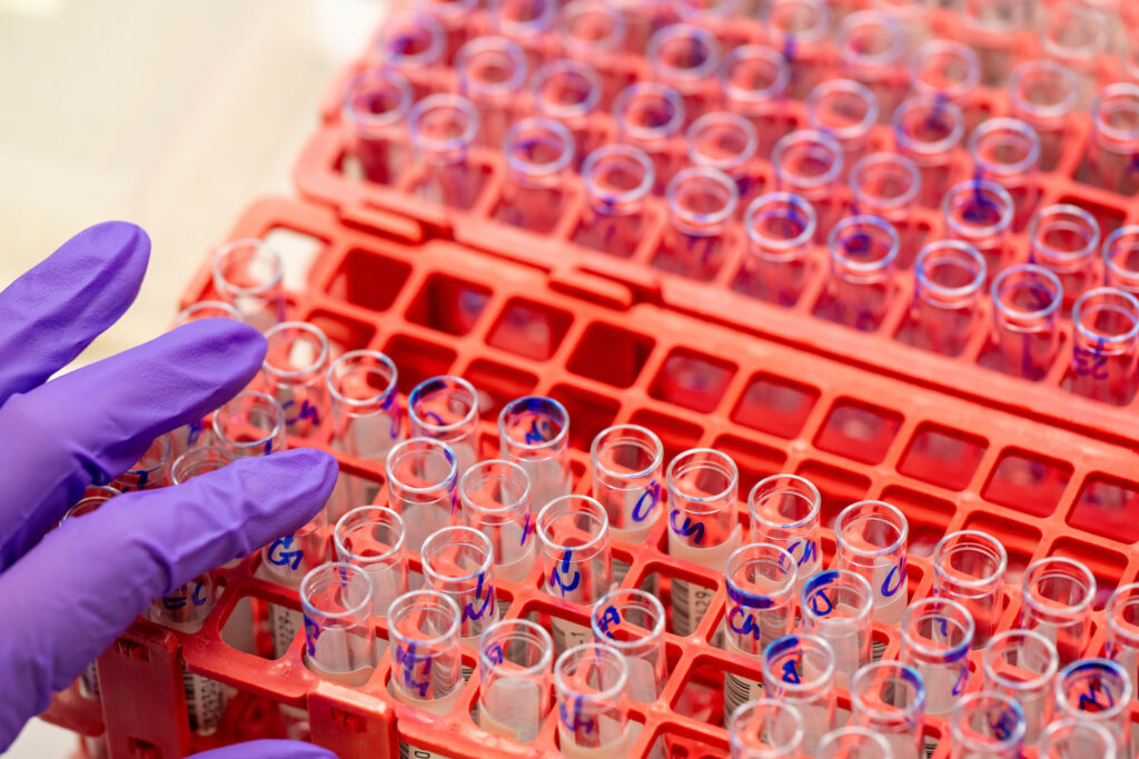 hand in purple glove touching tiny test tubes