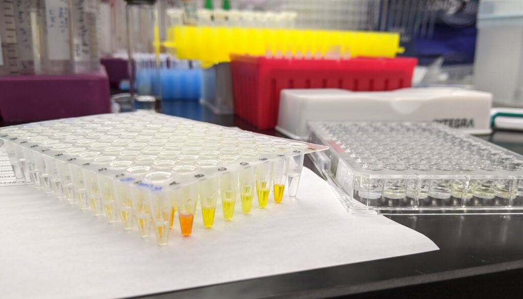Labeled tubes filled with liquid